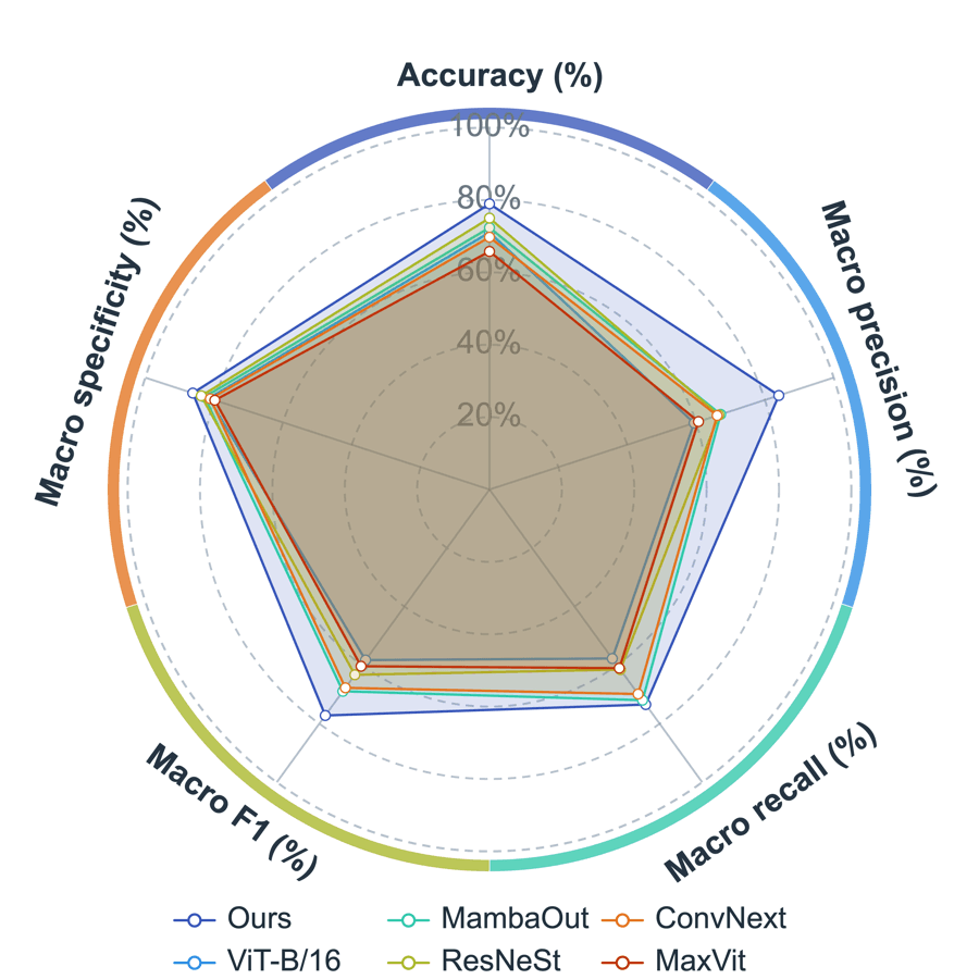 Radar Chart preview